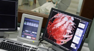 5 times cheaper? Siberian artificial heart to challenge European implants